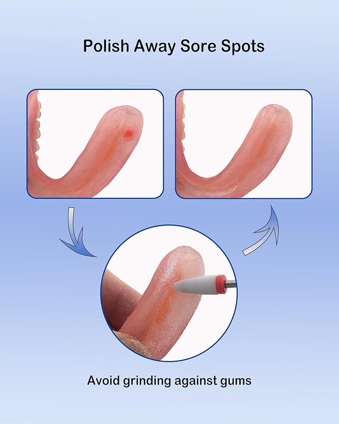 Polishing and Repair Kit for Acrylic Base and Reline Materials, At-Home Care to Adjust Sore Spots, Smooth Rough Edges, Remove Hardened Glue, Clean Stubborn Stains and Restore Shine