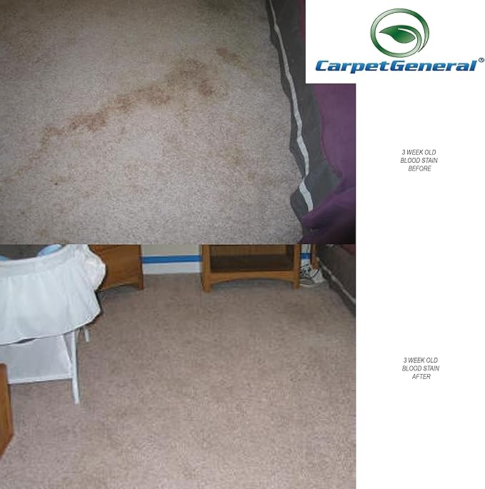 Carpet Spot Remover - Multi-Surface Carpet Stain Cleaner - Citrus Fragrance - Residential and Commercial Use - For Heavy-Duty Stains - Professional Grade - 1 Gallon Can